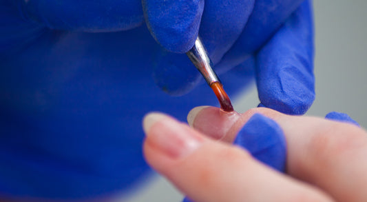 Diferentes tipos de gel